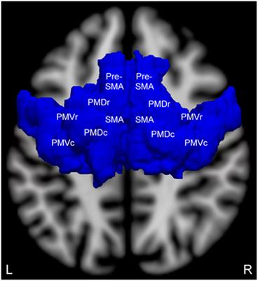 Functional MRI Motor Imagery Tasks to Detect Command Following in Traumatic Disorders of Consciousness